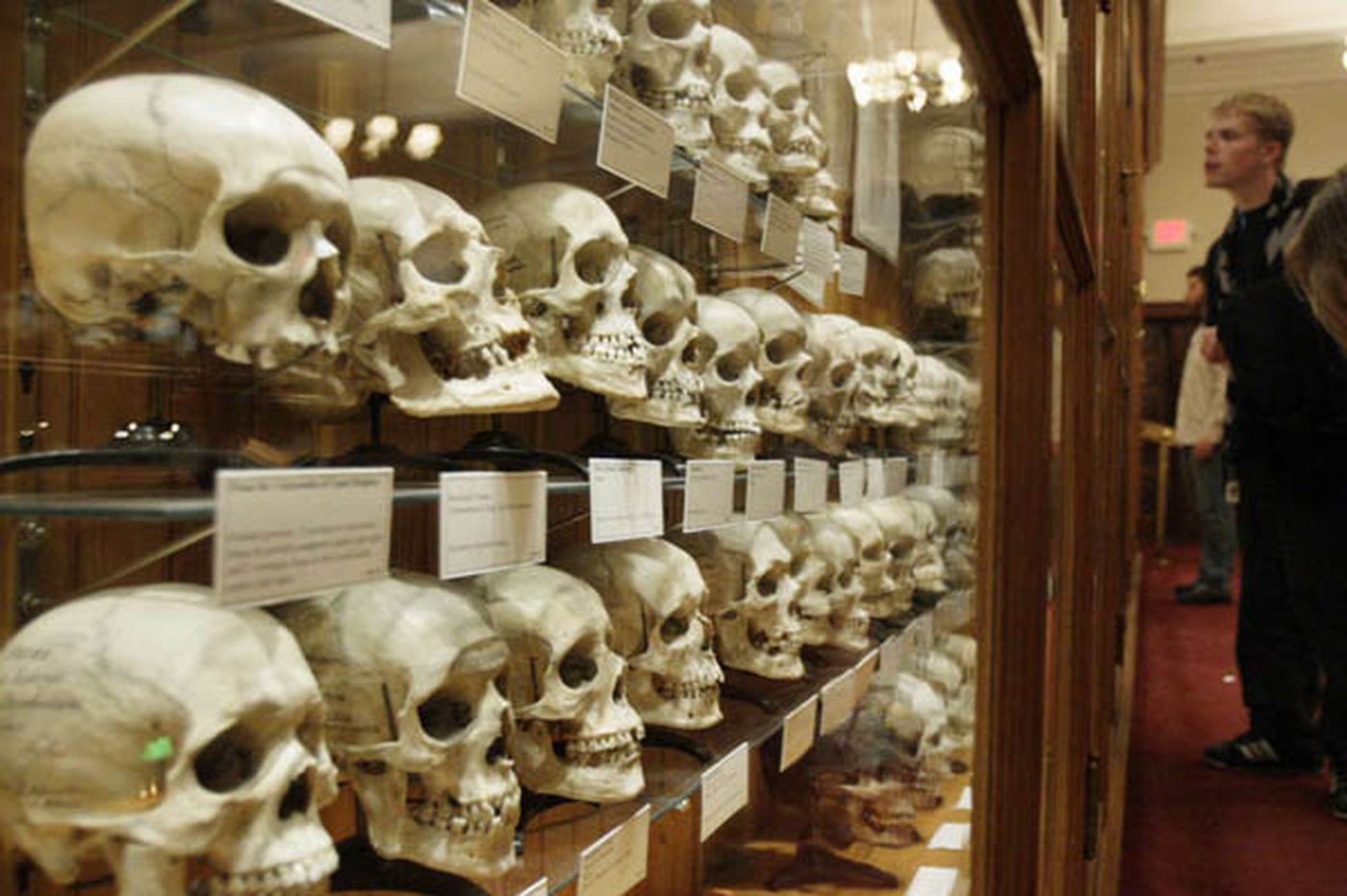 Mütter Museum, Exotic , Skulls