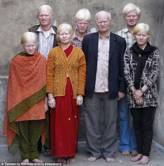 Worlds Biggest Albino Family