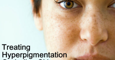 hyperpigmentation on indian skin