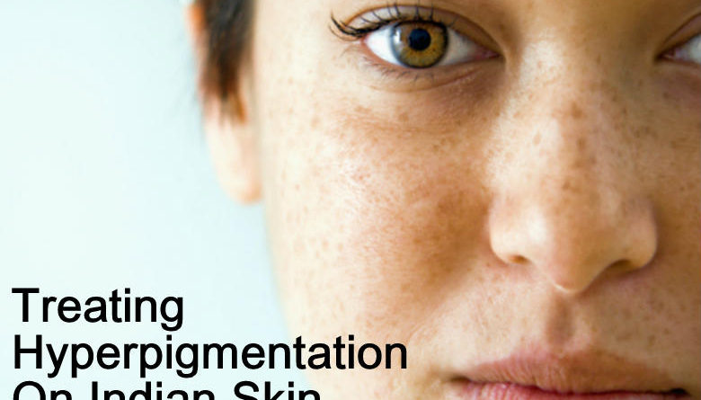 hyperpigmentation on indian skin