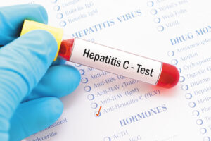 Image of diagnostic test for hepatitis C