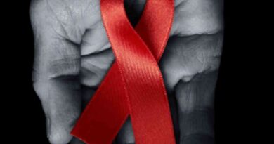 HIV and AIDS