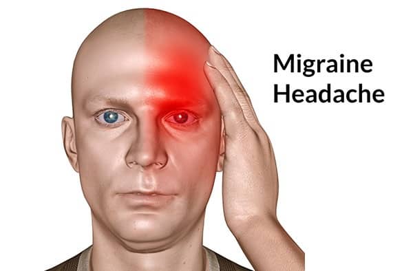 migraines