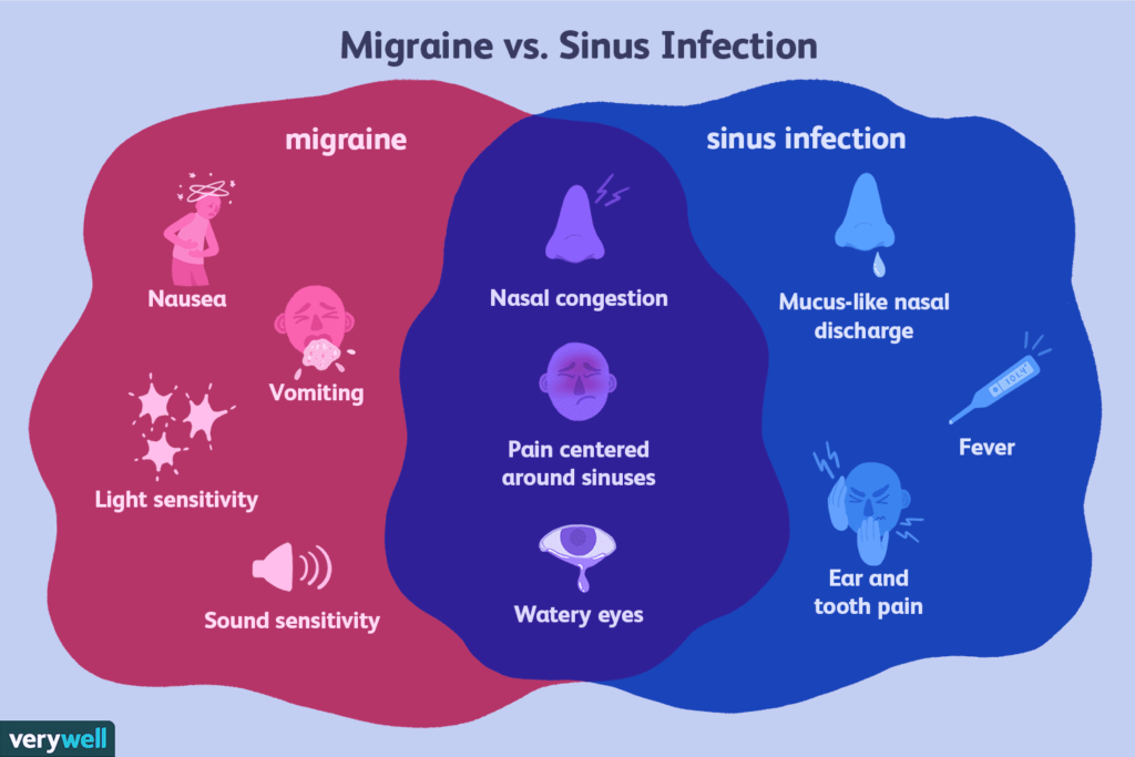 sinus versus Migraine