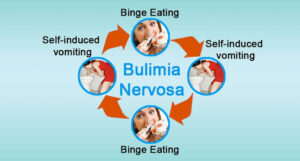 Bulimia